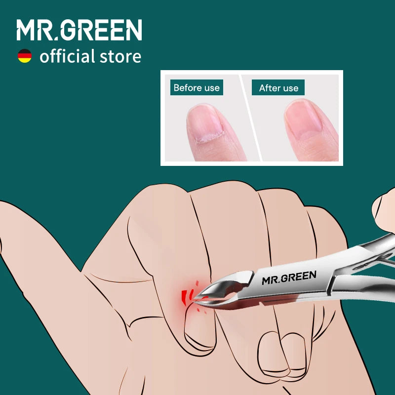 MR.GREEN Cuticle Nippers Stainless Steel Nail Care Clippers