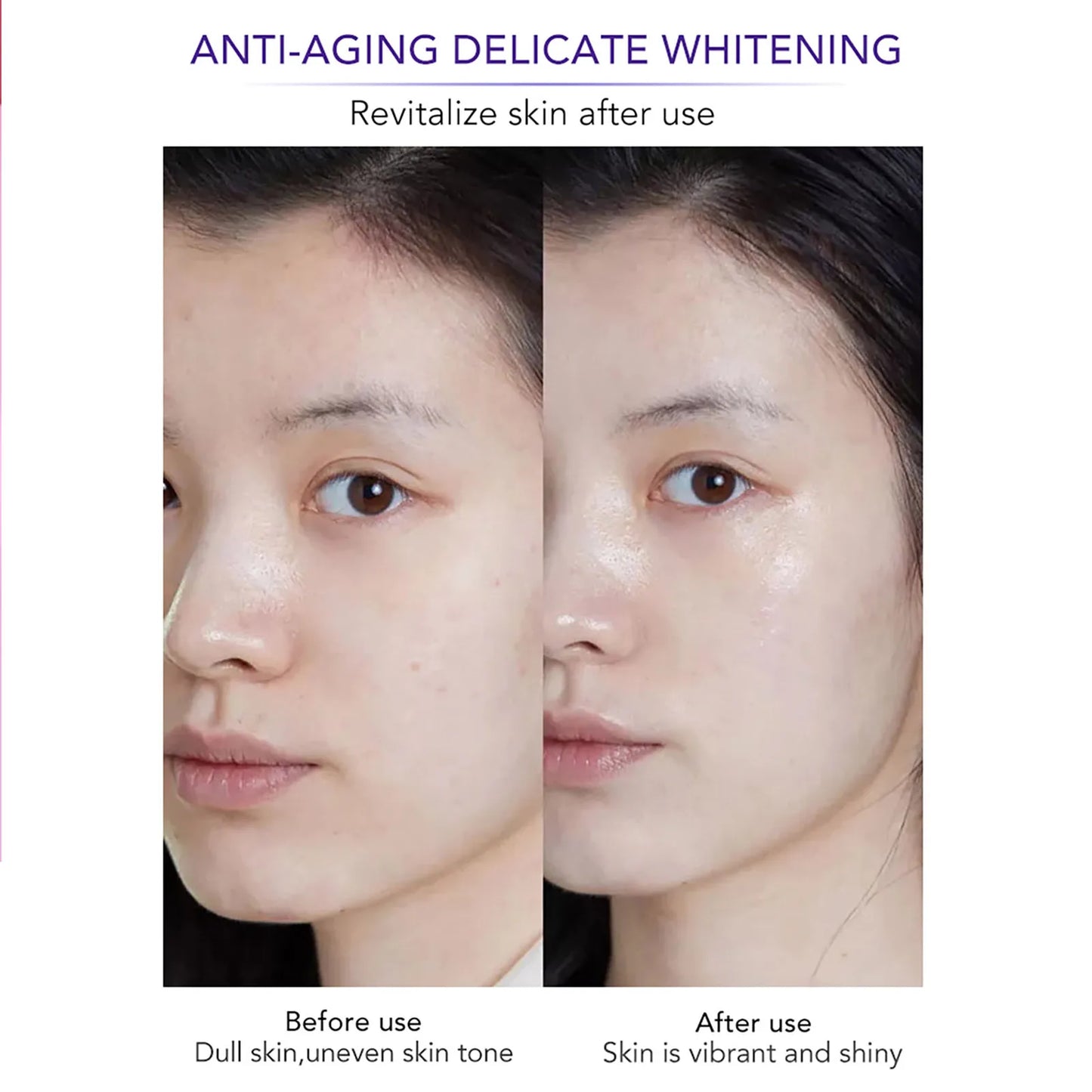 KYLIEFIT Whitening Anti Aging Freckle Face Cream Collagen Hyaluronic Acid