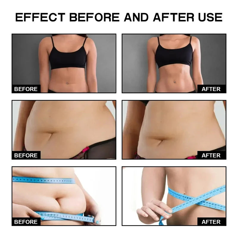 Jaysuing Fast Slimming Cream For Body Fat Burn And Firming